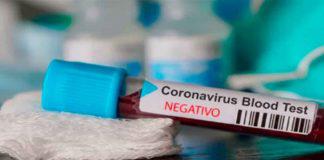 SM-CORONAVIRUS-NEGATIVO-324x160