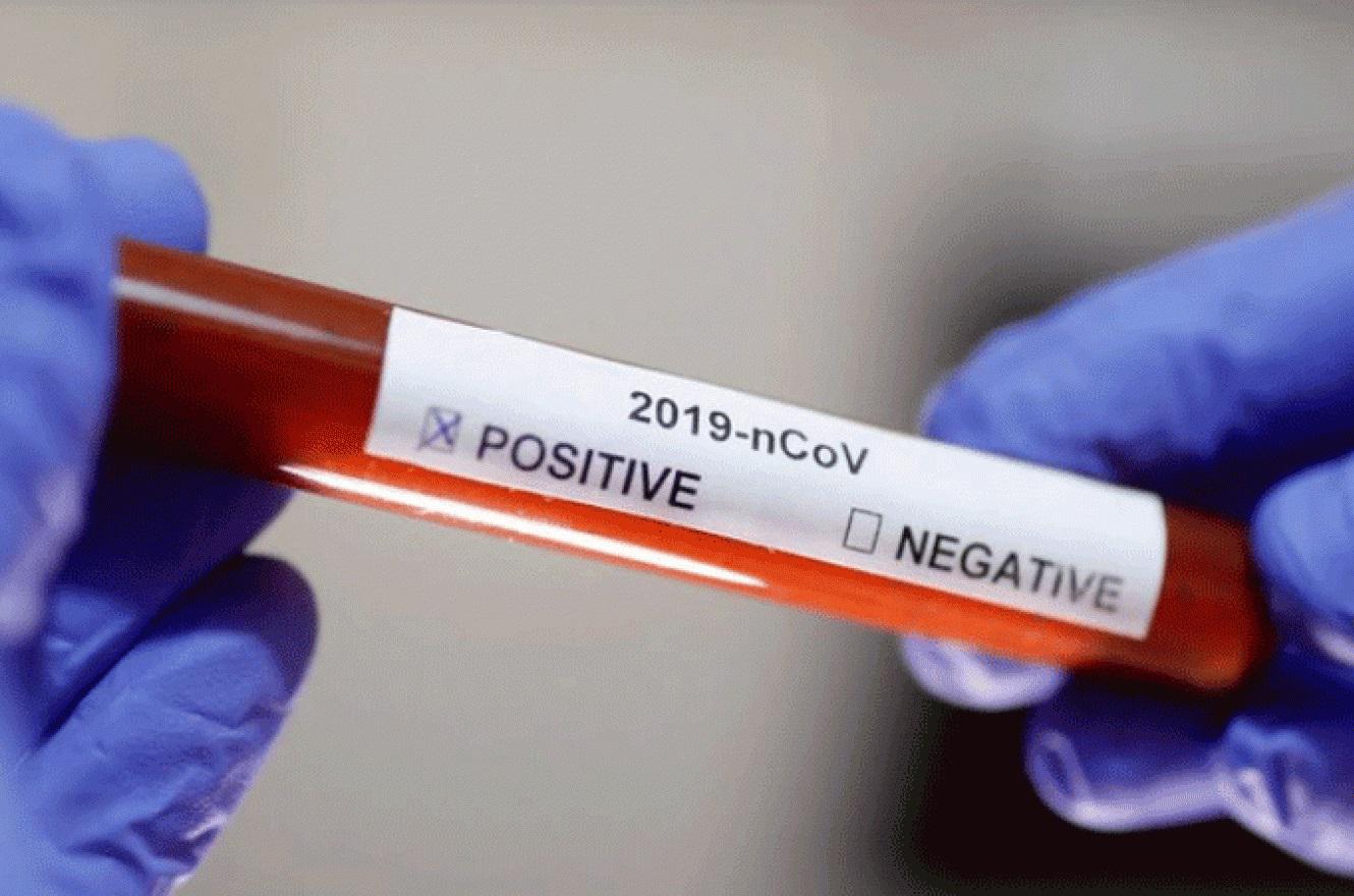 coronavirus analisis 2