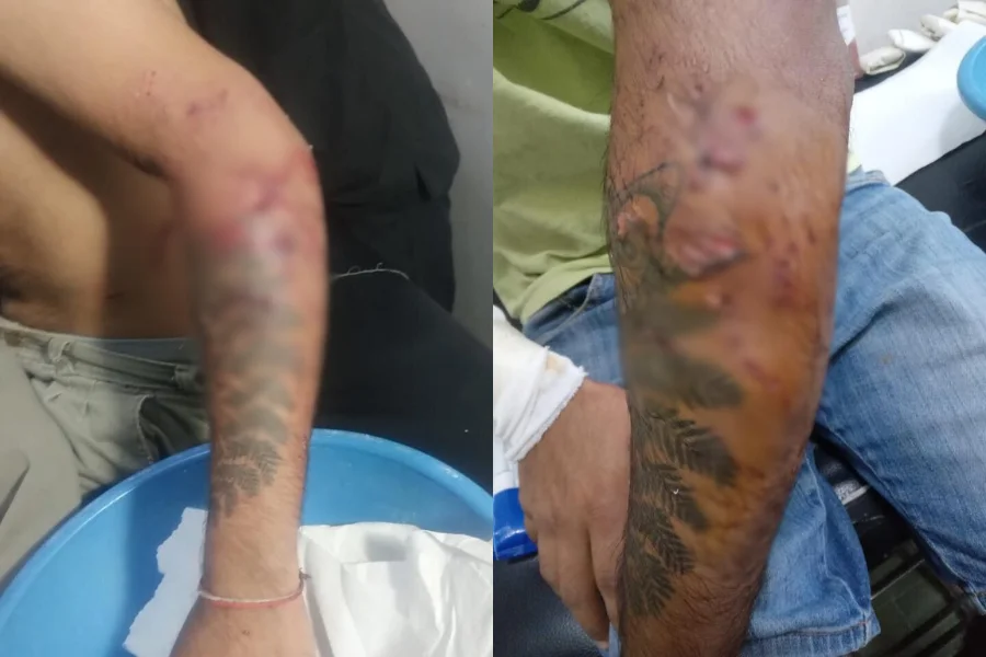 Humberto ataque de dogos